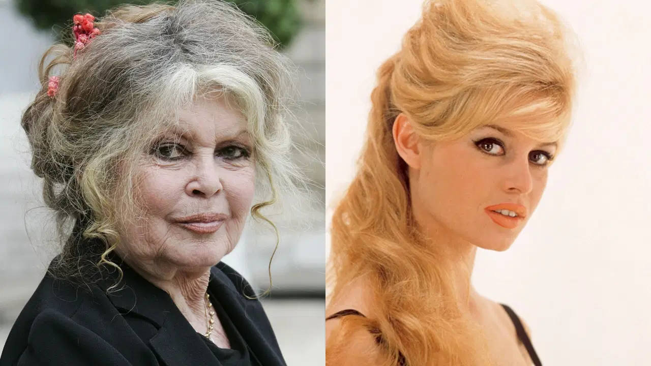 brigitte bardot ameliyat sonrasi taburcu edildi QyGi8s2W.jpg